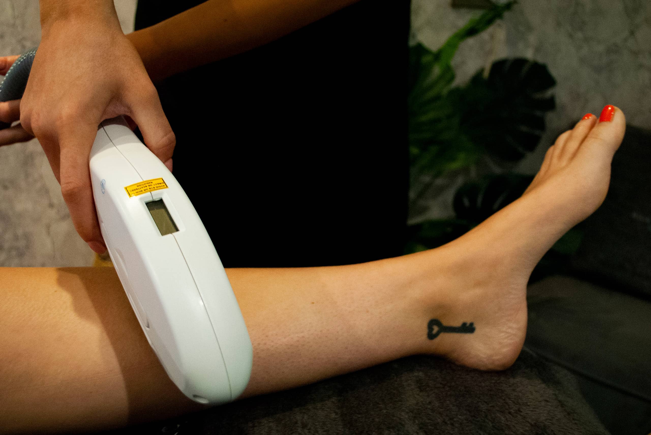 hairremoval